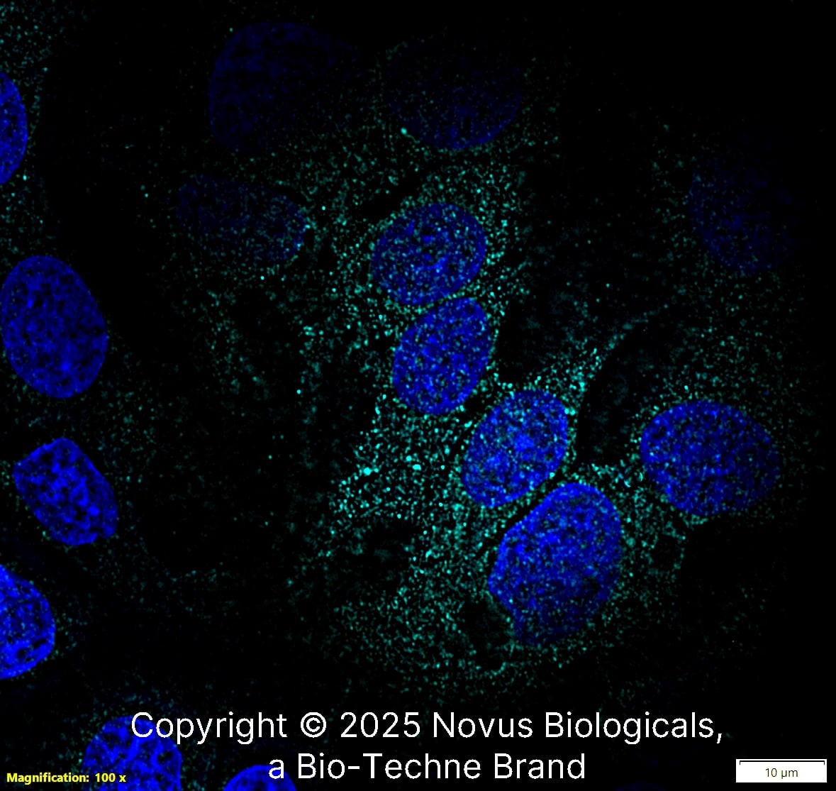 Fibronectin Antibody - BSA Free