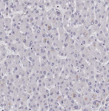 INPP4A Antibody
