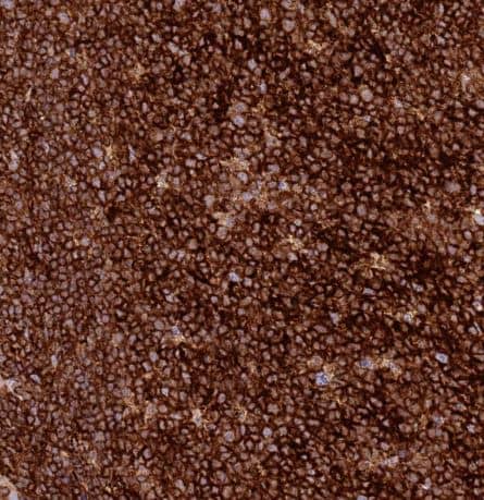 Immunohistochemistry-Paraffin: TTPAL Antibody [NBP1-92544]