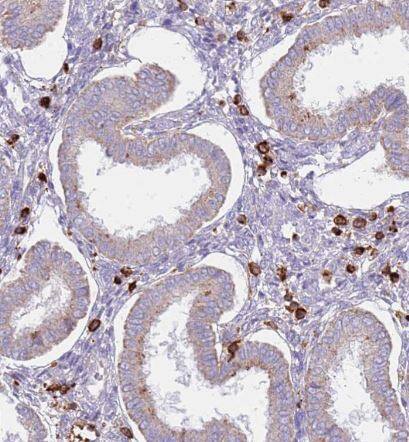 TTPAL- Antibody- NBP1-92544