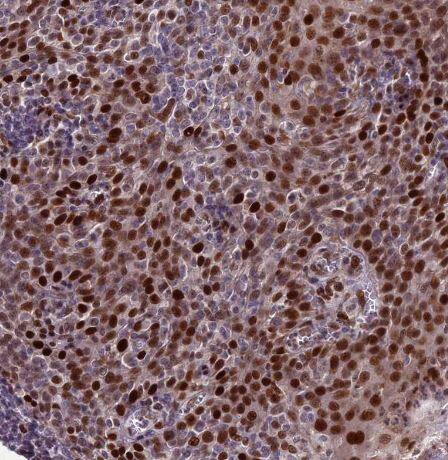 ZNF707 Antibody