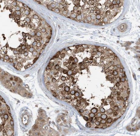 GOLGA4 Antibody