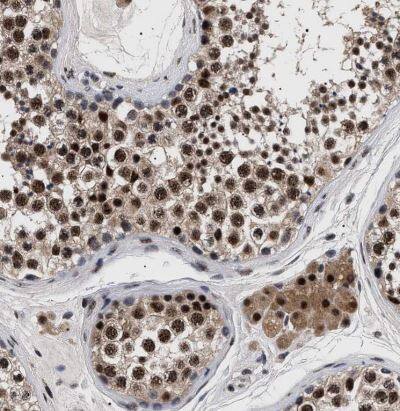 CAAP1 Antibody