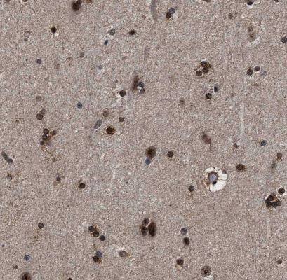 CAAP1 Antibody