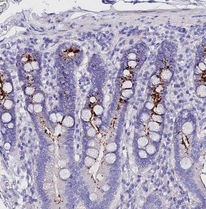 TMEM117 Antibody