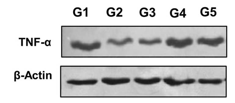TNF RI/TNFRSF1A Antibody - BSA Free
