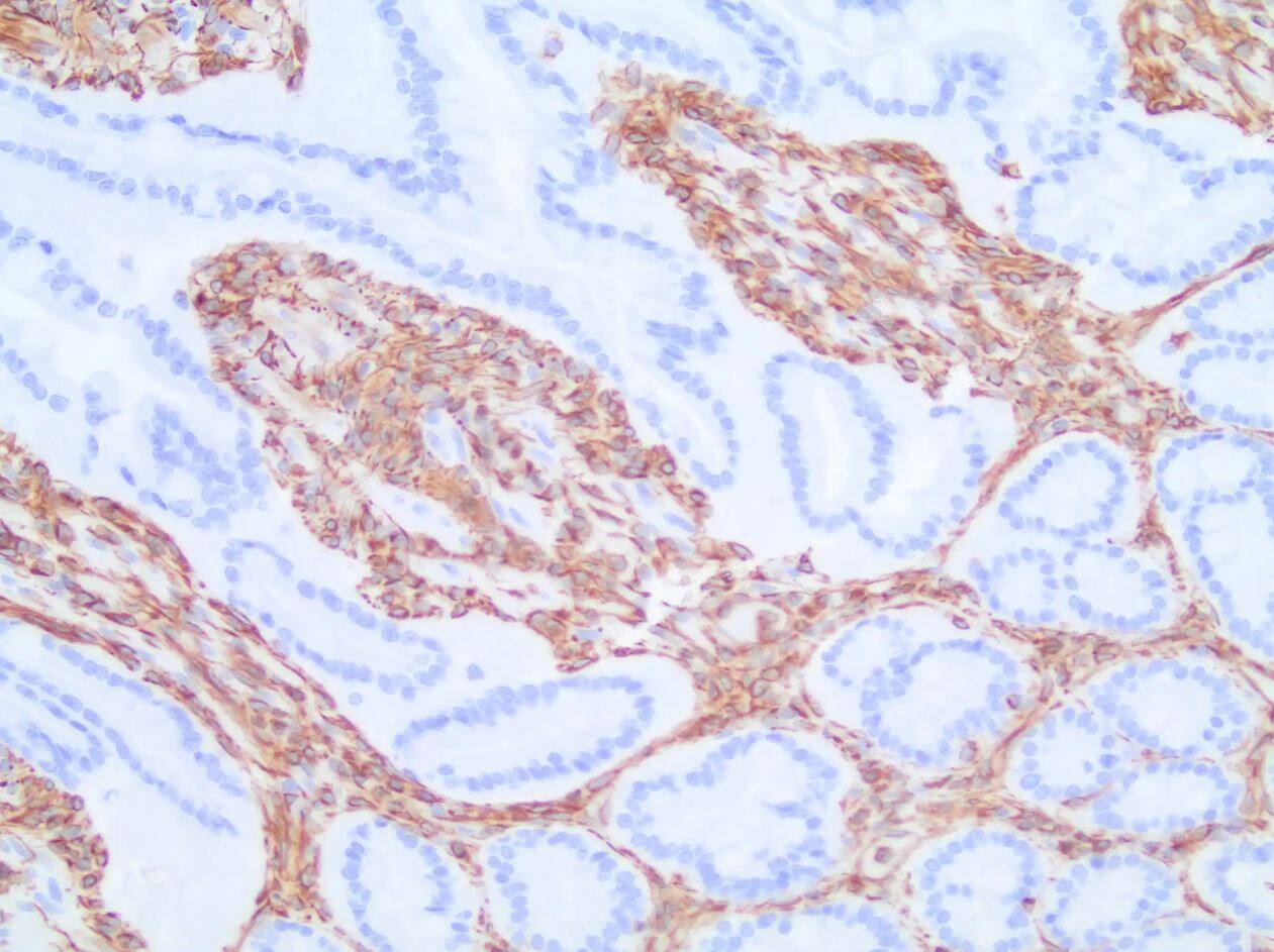 Vimentin Antibody (V9) - BSA Free