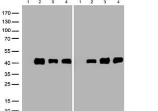LPAR1/LPA1/EDG-2 Antibody (OTI1G6)