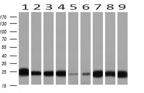 IgJ Antibody (OTI3B3)