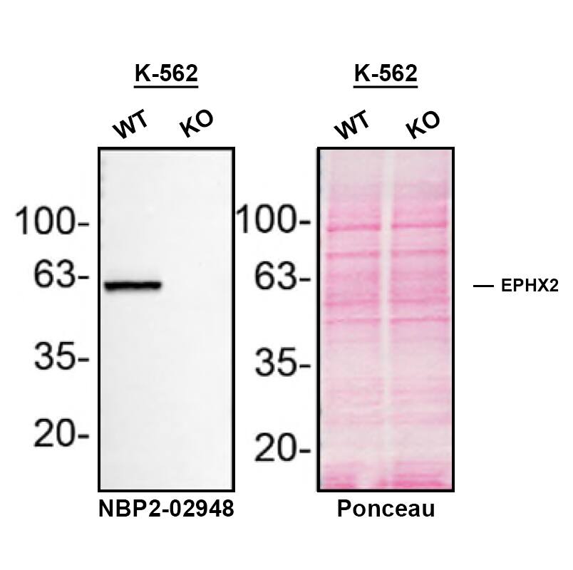 EPHX2 Antibody (OTI1A6) Western Blot Shows EPHX2 Specificity Using Knockout Cell Line.