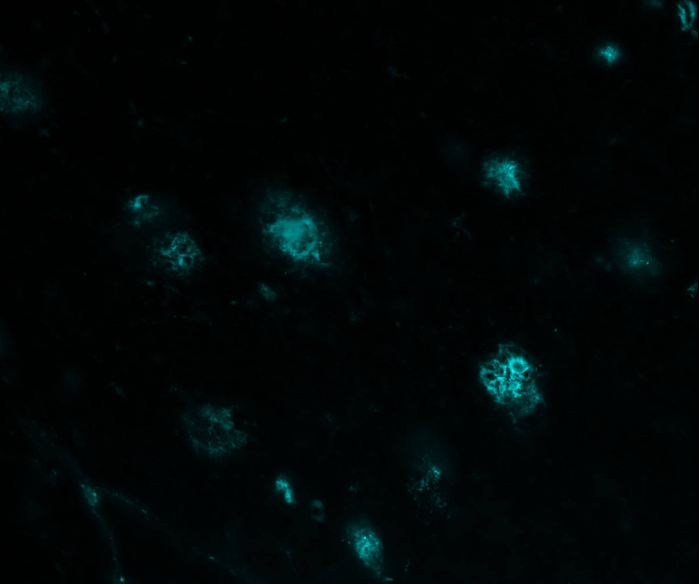 beta Amyloid Antibody (MOAB-2) - BSA Free
