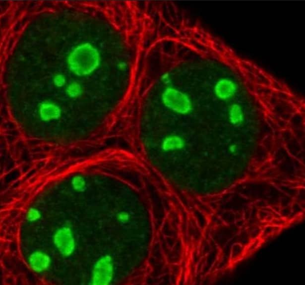 RRN3 Antibody Immunocytochemistry/ Immunofluorescence: RRN3 Antibody [NBP2-13267]