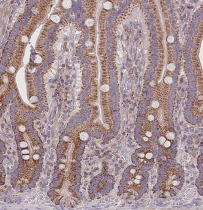 SLC25A42 Antibody - BSA Free