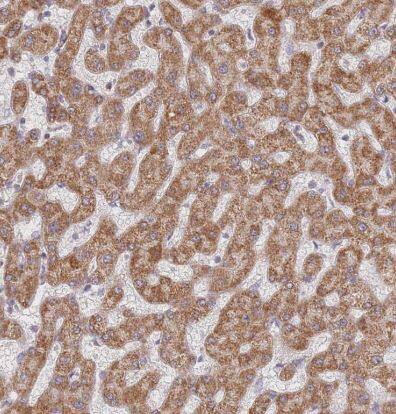 TIMM13 Antibody