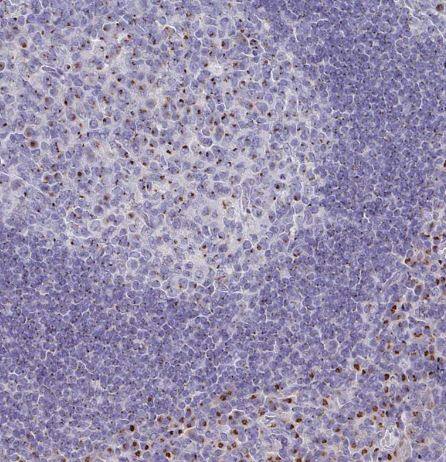 VKORC1L1 Antibody