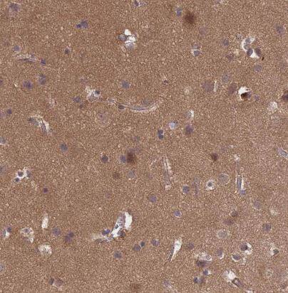 Puromycin-sensitive aminopeptidase/NPEPPS Antibody