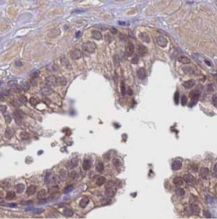 Puromycin-sensitive aminopeptidase/NPEPPS Antibody