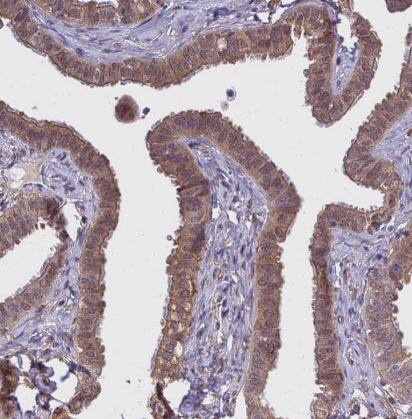 Puromycin-sensitive aminopeptidase/NPEPPS Antibody