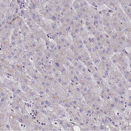 Puromycin-sensitive aminopeptidase/NPEPPS Antibody