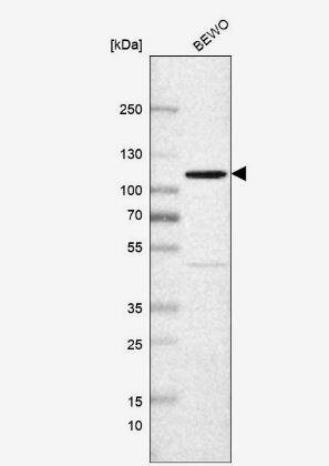 Puromycin-sensitive aminopeptidase/NPEPPS Antibody