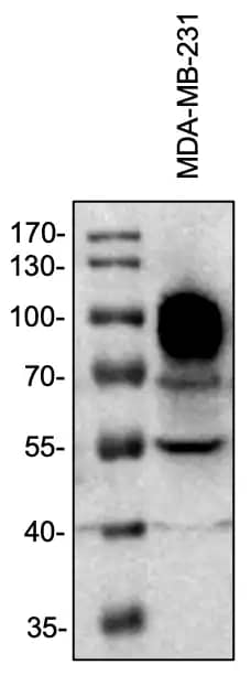 Collagen XIII alpha 1 Antibody