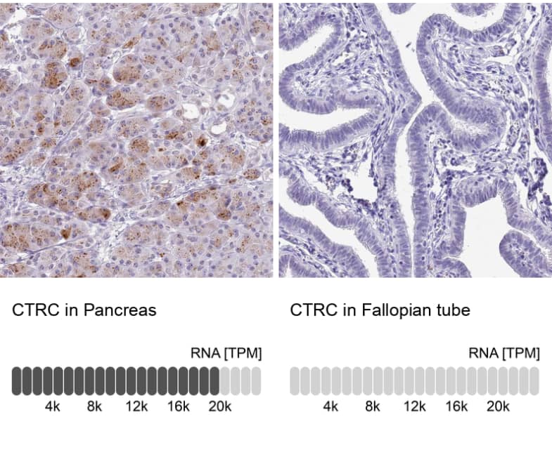 Chymotrypsin C/CTRC Antibody - BSA Free