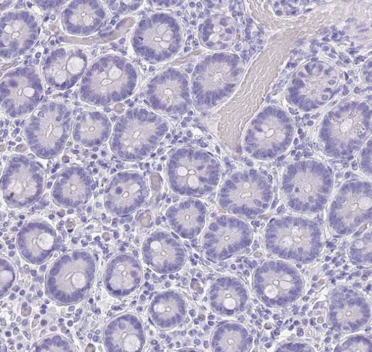 Chymotrypsin C/CTRC Antibody - BSA Free