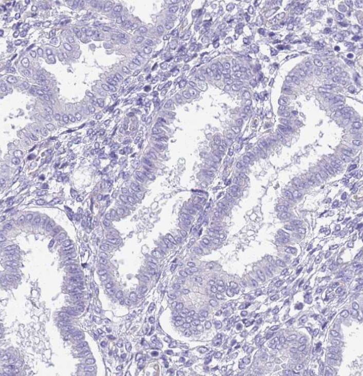 Chymotrypsin C/CTRC Antibody - BSA Free