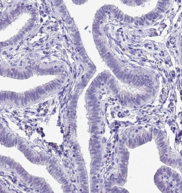Chymotrypsin C/CTRC Antibody - BSA Free