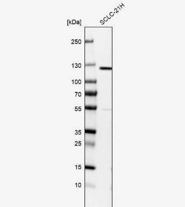DGK-zeta Antibody