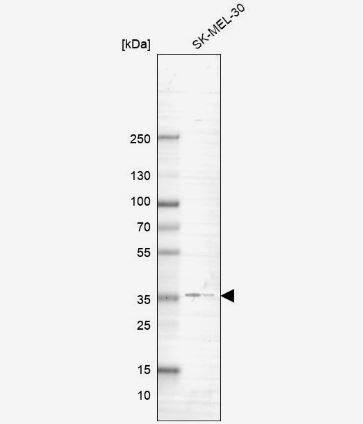 G protein beta 4 Antibody