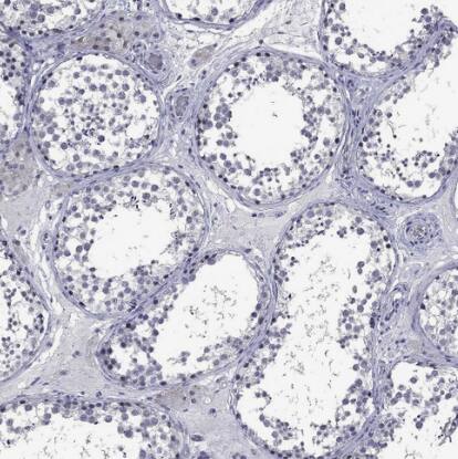 5-HT4 Antibody - BSA Free
