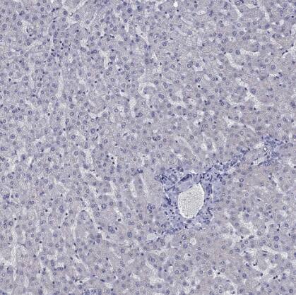 5-HT4 Antibody - BSA Free