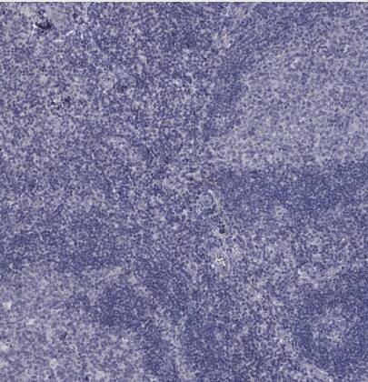 5-HT4 Antibody - BSA Free