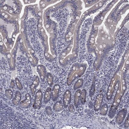 5-HT4 Antibody - BSA Free