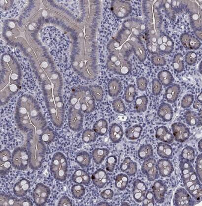 5-HT4 Antibody - BSA Free