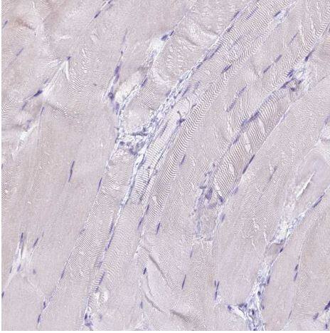 Bradykinin RB2/BDKRB2 Antibody