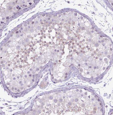 Bradykinin RB2/BDKRB2 Antibody