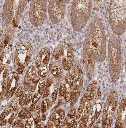 UQCC3 Antibody