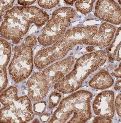 UQCC3 Antibody