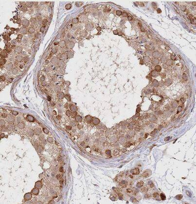UQCC3 Antibody