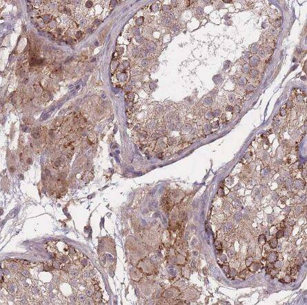 TMEM232 Antibody