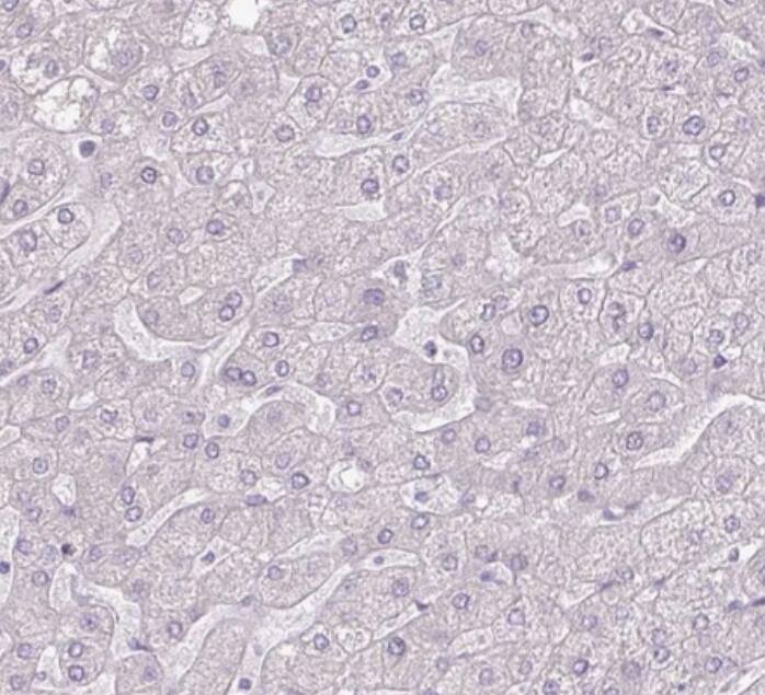 Thyroglobulin Antibody (CL0164) - BSA Free