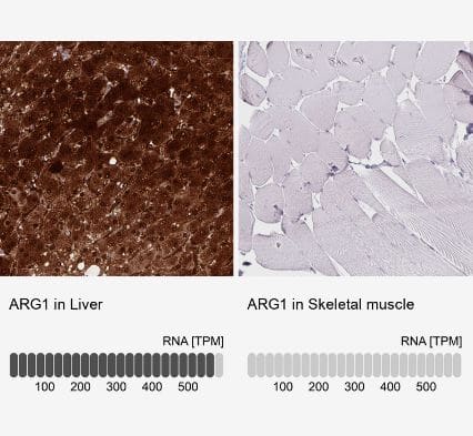 Arginase 1/ARG1/liver Arginase Antibody (CL0186)