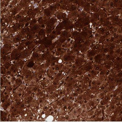 Arginase 1/ARG1/liver Arginase Antibody (CL0186)