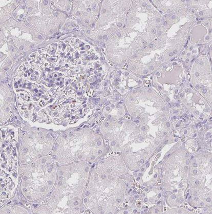 Arginase 1/ARG1/liver Arginase Antibody (CL0186)