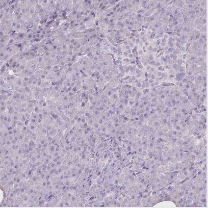 Arginase 1/ARG1/liver Arginase Antibody (CL0186)