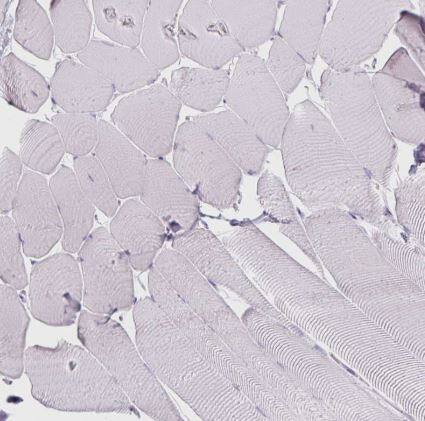 Arginase 1/ARG1/liver Arginase Antibody (CL0186)