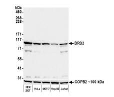 BRD2 Antibody (12C2E4)
