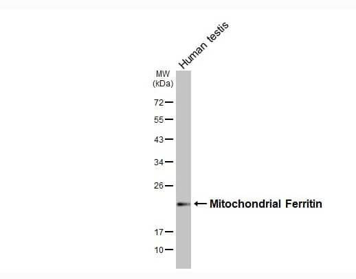 Ferritin mitochondrial Antibody